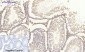 Glut1 Polyclonal Antibody